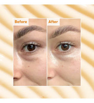 Ren Clean Skincare - Brightening Dark Circle Eye Cream - -radiance Bright Eye Cream 15ml