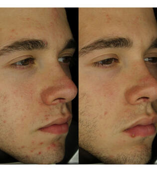 AMELIORATE Transforming Clarity Facial Serum 30ml