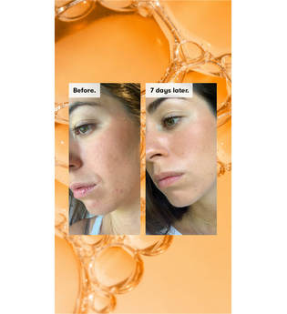 Ren Clean Skincare - Ready Steady Glow Daily Aha Tonic - -radiance Ready Steady Glow Tonic 250ml