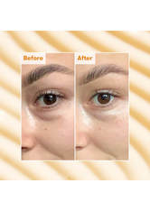 Ren Clean Skincare - Brightening Dark Circle Eye Cream - -radiance Bright Eye Cream 15ml