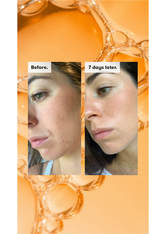 Ren Clean Skincare - Ready Steady Glow Daily Aha Tonic - -radiance Ready Steady Glow Tonic 250ml